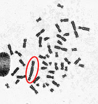closeup of slide showing a dicentric spread of 45 chromosomes