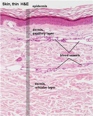 Sections of normal skin, thin